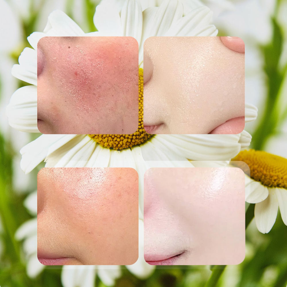 Face Mask Skincare - Masque facial en feuille Fykly Rose